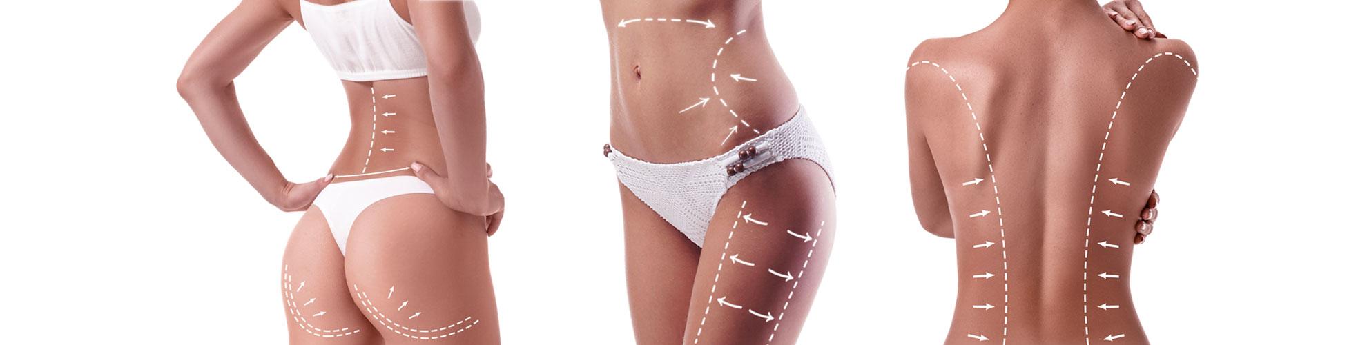 Body Contouring, Body Cosmetic Surgery